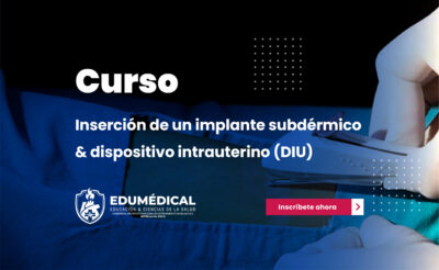 Insercion de un implante subdermico y dispositivo intrauterino (DIU)